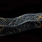 Stent Biliary Uncovered (Uncovered)